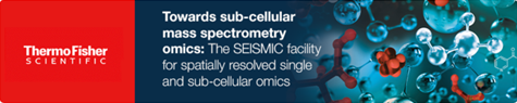 Towards%20sub-cellular%20mass%20spectrom